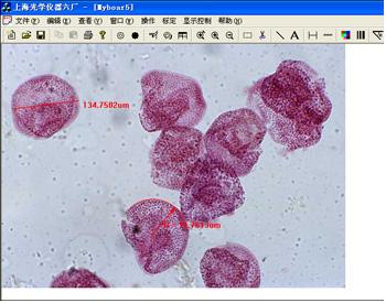 細(xì)胞測量圖片