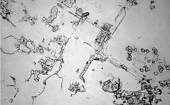 學生顯微鏡下的微觀大世界——眼淚