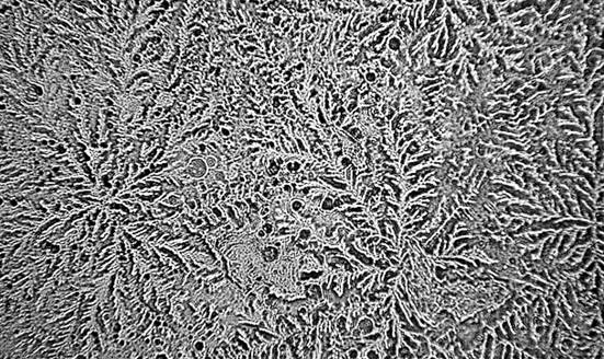 學生顯微鏡下的微觀大世界——眼淚