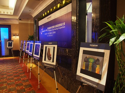 第四屆奧林巴斯顯微鏡全國(guó)顯微圖像大賽獲獎(jiǎng)選手訪談