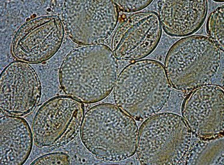 顯微鏡探索微觀世界的精彩:美麗的飛絮: