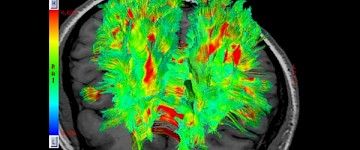 微觀世界：激光共聚焦與核磁共振顯微鏡下的精彩世界