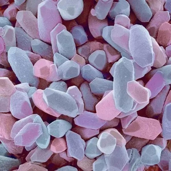 內(nèi)耳平衡石