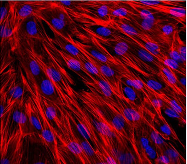 激光共聚焦顯微鏡“孔雀羽毛”
