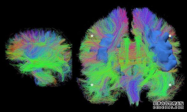 科學(xué)家?guī)闵钊肓私怙@微鏡下的大腦組織