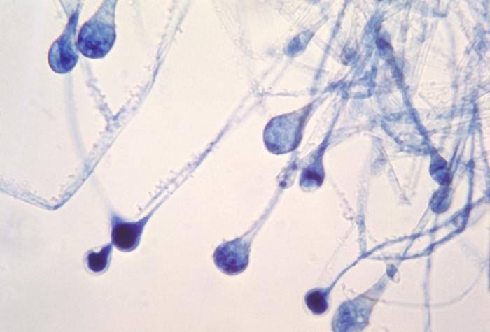 霉菌在發(fā)酵罐