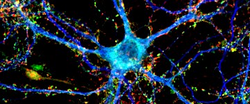 按顯微鏡類型、應(yīng)用、最終用戶、地區(qū)劃分的顯微鏡軟件市場(chǎng)研究報(bào)告
