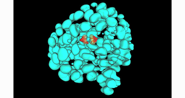 乳腺上皮微球體 乳腺上皮微球體