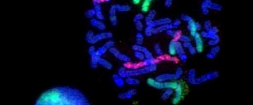 數(shù)碼熒光顯微鏡使用過程中過濾不需要的熒光