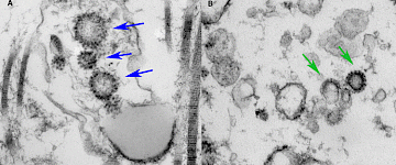 COVID-19也許會影響男性生殖健康