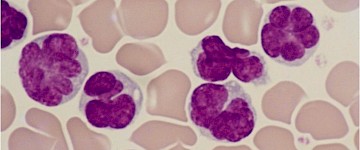 解密病毒如何將免疫細(xì)胞轉(zhuǎn)化為癌癥