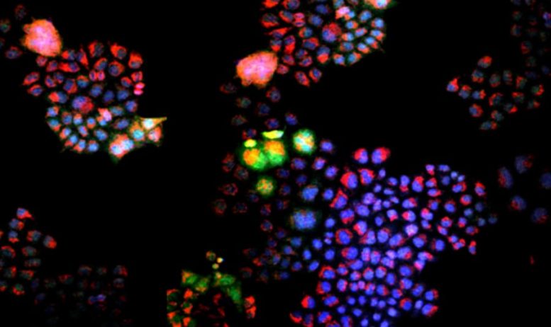熒光顯微鏡腫瘤樣本