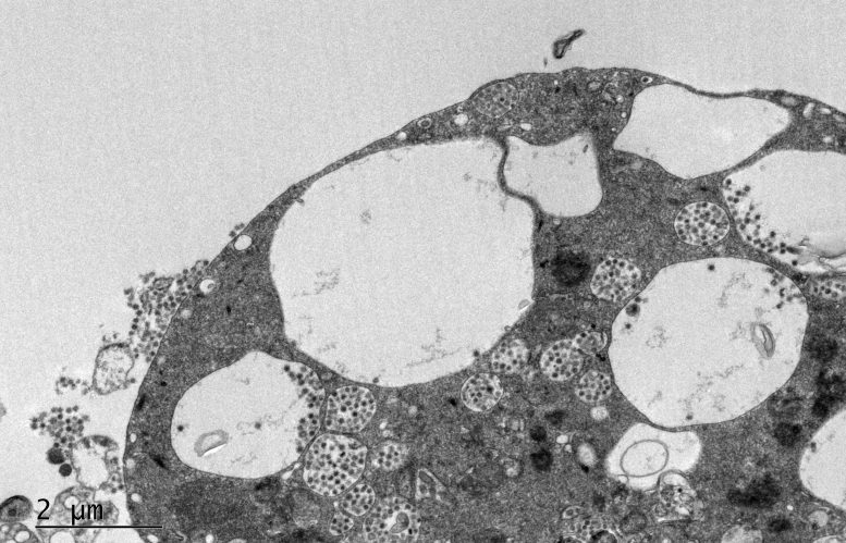 用 NLuc 標(biāo)記的 SARS-CoV-2 病毒感染的 Vero 細(xì)胞